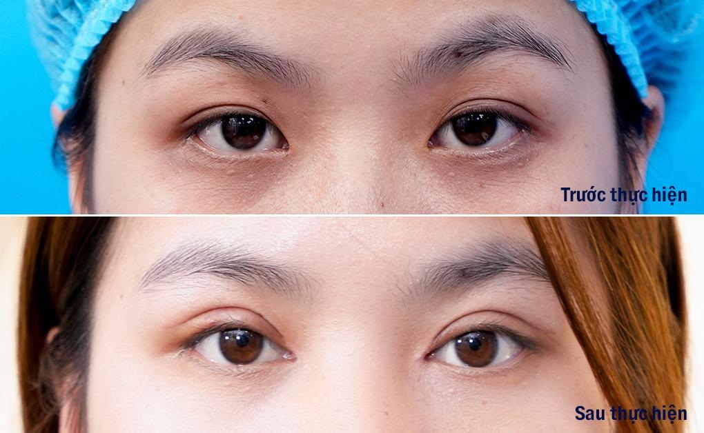 Làm đẹp đón năm mới - 2 Làm đẹp đón năm mới - 2