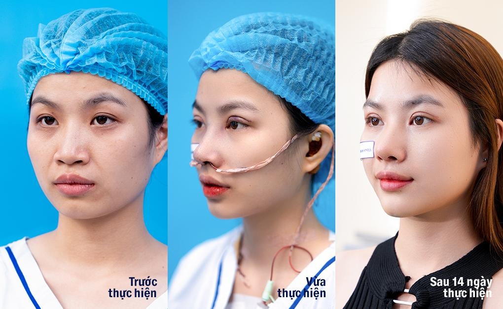 Làm đẹp đón năm mới - 3 Làm đẹp đón năm mới - 3