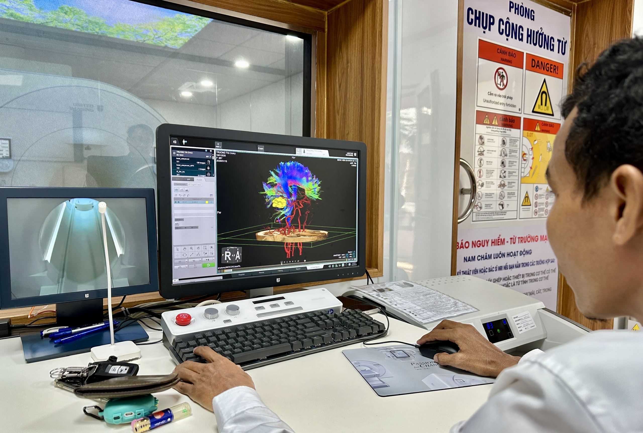 Hậu Giang: Ra mắt hệ thống MRI 3.0 Tesla chẩn đoán sớm ung thư, đột quỵ- Ảnh 3. Hậu Giang: Ra mắt hệ thống MRI 3.0 Tesla chẩn đoán sớm ung thư, đột quỵ- Ảnh 3.