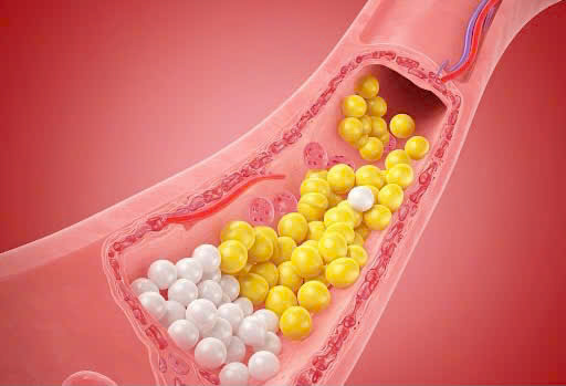 Những món tiếp khách ngày tết không ngờ giảm cholesterol, ngừa đau tim cực hay- Ảnh 2. Những món tiếp khách ngày tết không ngờ giảm cholesterol, ngừa đau tim cực hay- Ảnh 2.