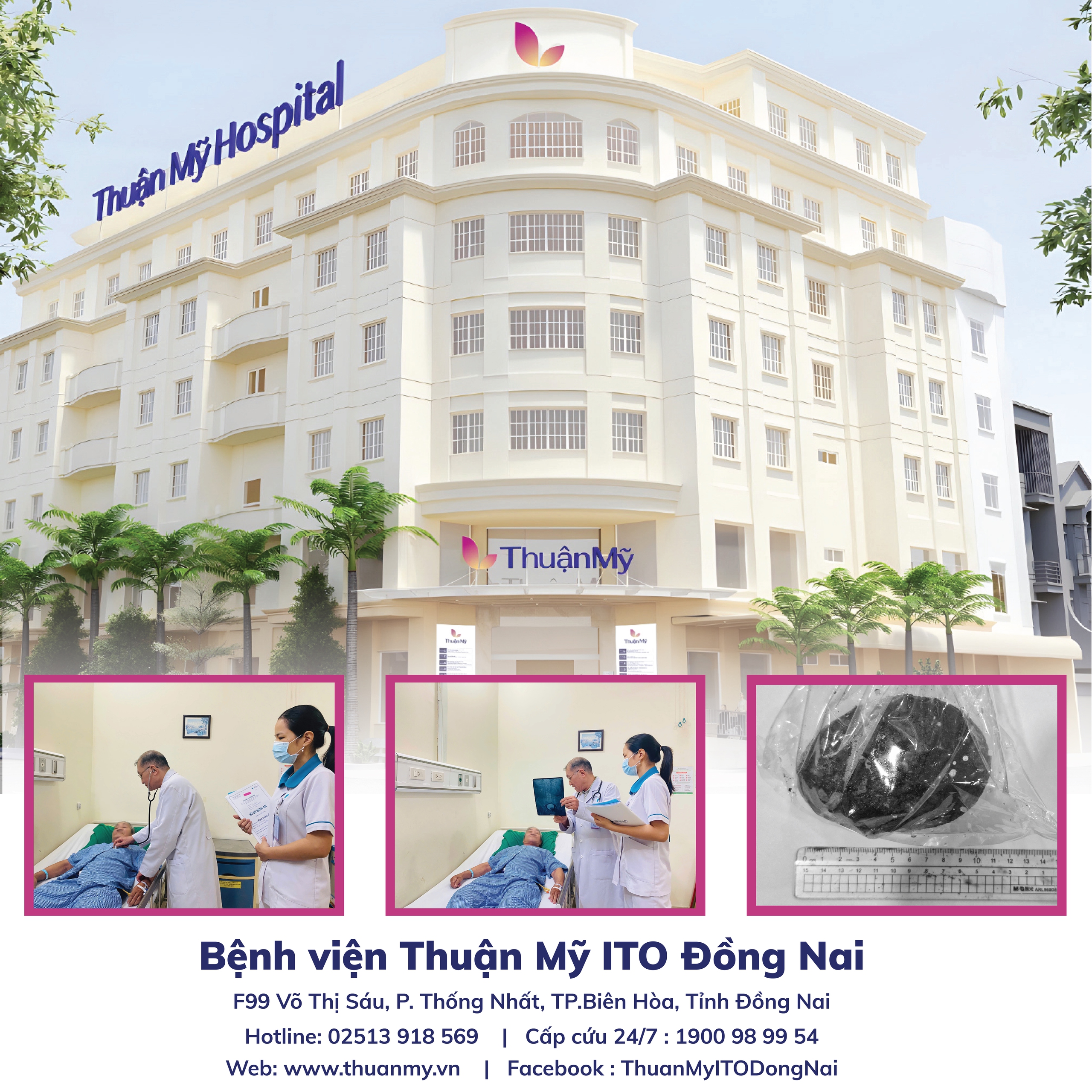 Bệnh viện Thuận Mỹ ITO Đồng Nai phẫu thuật thành công ca sỏi bàng quang hiếm gặp- Ảnh 1. Bệnh viện Thuận Mỹ ITO Đồng Nai phẫu thuật thành công ca sỏi bàng quang hiếm gặp- Ảnh 1.
