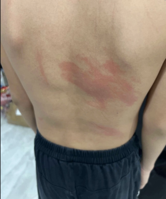 Vụ tố cáo HLV taekwondo đánh võ sinh: UBND quận chỉ đạo khẩn trương kiểm tra- Ảnh 1. taekwondo
